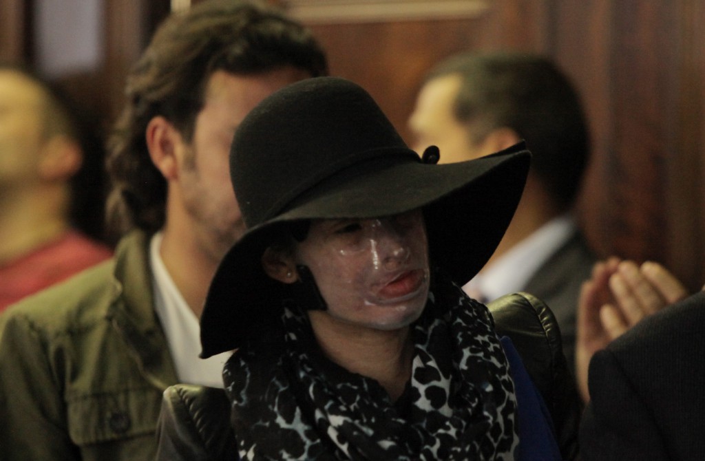 BOG41. BOGOTÁ (COLOMBIA), 16/04/2015.- La joven colombiana Natalia Ponce de León, atacada con ácido el año pasado, participa en el lanzamiento del libro "El renacimiento de Natalia Ponce de León" hoy, jueves 16 de abril de 2015, en Bogotá (Colombia). Ponce de León, que el año pasado se convirtió en símbolo nacional de las víctimas de ataques con ácido tras ser rociada en el rostro con un corrosivo sulfúrico, hizo hoy su primera aparición en público para presentar un libro sobre su drama. EFE/Iván Valencia COLOMBIA VIOLENCIA