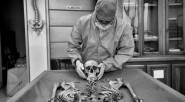 Un forense examina unos restos en un laboratorio de Medellín. En toda Colombia, en cerca de 4500 fosas, se han recuperado más de 6000 cuerpos sin identificar. Hasta hoy, ni [&hellip;]