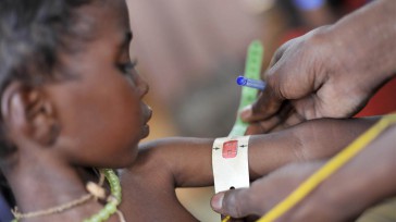 Niños con desnutrición severa y múltiples enfermedades asociadas a la desnutrición. &nbsp; &nbsp; &nbsp; &nbsp; Rafael Camargo La Orinoquía  165 niños y niñas en La Orinoquía que padecen enfermedades asociadas a este grave [&hellip;]
