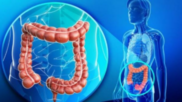 En Colombia, este tipo de cáncer causó 9.140 casos nuevos y 4.405 muertes en 2018. Según el Registro de Cáncer de Cali, el riesgo de este cáncer se había duplicado [&hellip;]
