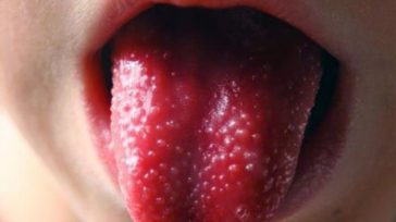 Una alerta urgente sobre un aumento de contagios en los niños ingresados en cuidados intensivos con una afección relacionada con el coronavirus. &nbsp; &nbsp; &nbsp; &nbsp; &nbsp; &nbsp; GISSELLE ACEVEDO [&hellip;]