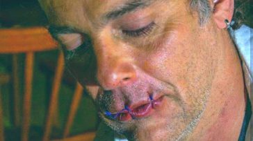 El escultor Jhon fitzgerard, se cosió la boca reclamando ayuda del gobierno para el sector cultural.   &nbsp;  Hernán Durango Orbedatos Agencia de Noticias Se trata del escultor Jhon fitzgerard, embajador [&hellip;]