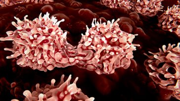 Las Neoplasias Mieloproliferativas son un conjunto de cánceres de la sangre que se desarrollan en la médula ósea y que pueden ser positivas o negativas para un marcador genético. &nbsp; [&hellip;]