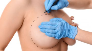 Aunque su uso se remonta a la década de 1960, los implantes actuales son el resultado de más de seis décadas de investigación   Salud La cirugía de aumento mamario […]