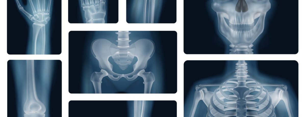 Rayos X Robin Prieto En el invierno de 1895, en un rincón de la Universidad de Würzburg, la ciencia cambió para siempre por un destello accidental. El físico alemán Wilhelm [&hellip;]