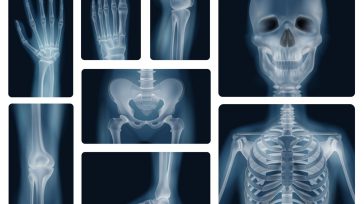 Rayos X Robin Prieto En el invierno de 1895, en un rincón de la Universidad de Würzburg, la ciencia cambió para siempre por un destello accidental. El físico alemán Wilhelm [&hellip;]