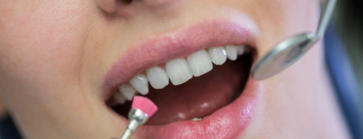 La regla de oro para una estética responsable es garantizar la salud de encías y dientes antes de intervenir, priorizando siempre la supervisión profesional. &nbsp; &nbsp; &nbsp; María Camila Zabala [&hellip;]