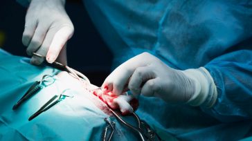 Las suturas quirúrgicas constituyen uno de los instrumentos más antiguos y esenciales de la medicina. Desde los primeros intentos rudimentarios por cerrar heridas traumáticas hasta los complejos procedimientos de la [&hellip;]